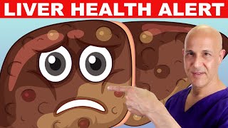 Avoid 1 Food That's Making Your LIVER Sick!  Dr. Mandell by motivationaldoc 110,875 views 2 weeks ago 5 minutes, 47 seconds