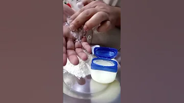 علاج الاكزيما بالبيت 