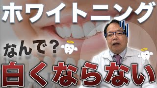 【残念】ホワイトニングで白くならなかった人へ。実は”白くなる方法”があります。【必見】