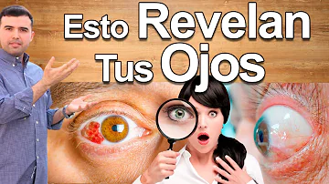 ¿Cómo revelan los ojos los problemas cardiacos?