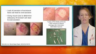 Innovations in Regenerative Medicine Therapy for Severe Burns and Other Complex Skin Defects screenshot 4