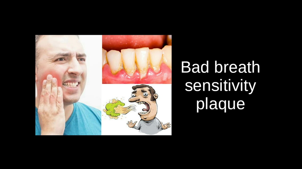 TEETH SENSITIVITY,BAD BREATH AND PLAGUE CURED IN 7DAY'S WITH RJUV9 TOOTH CONCENTRATE