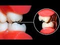 17 MUST-KNOW TEETH HACKS