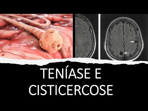 Teníase e Cisticercose