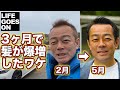 ついに話します! 50のおじさんの髪が3ヶ月で爆増したワケ Part.1