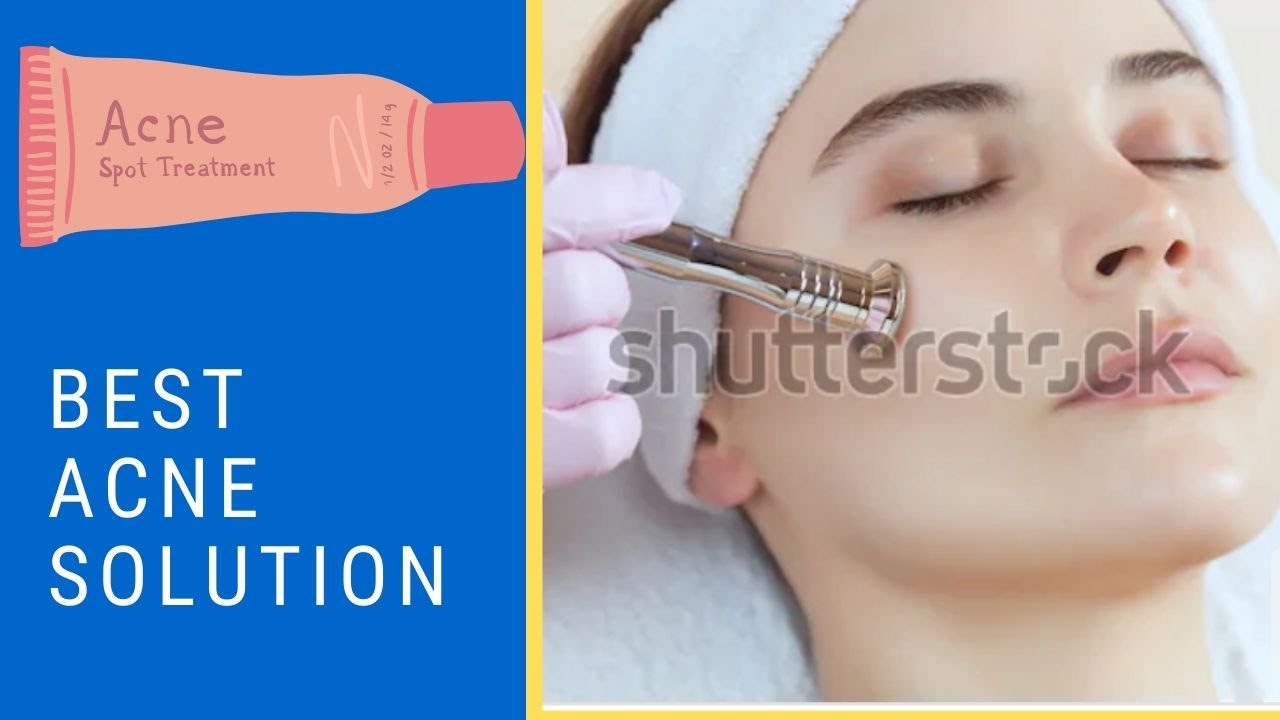 How to solve acne problem {pimples removal methods} - YouTube