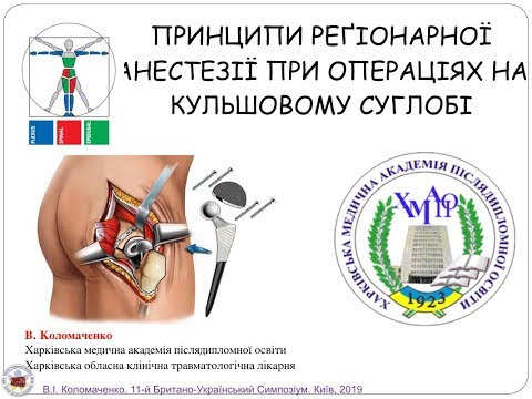 Принципи реґіонарної анестезії при операціях на кульшовому суглобі. В.І. Коломаченко