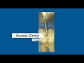 Access Cavity Preparation for molars