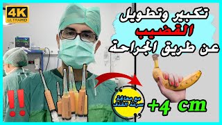 عملية تكبير القضيب (طول وعرض) 4+ - مع الدكتور محسن بالابان