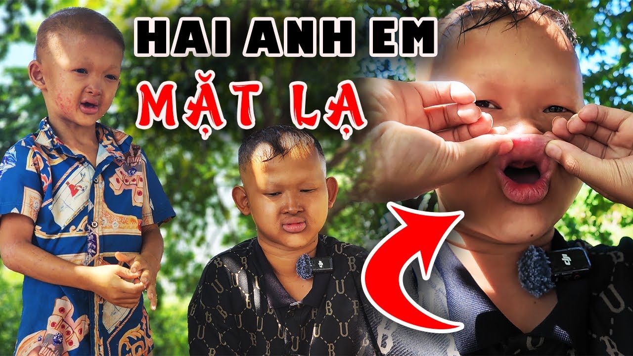 Phát hiện hai anh em gương mặt lạ cha mẹ đã 