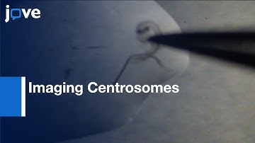 Imaging Centrosomes In Fly Testes l Protocol Preview