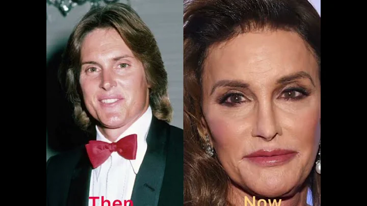 Famous celebrities you never knew were transgender people