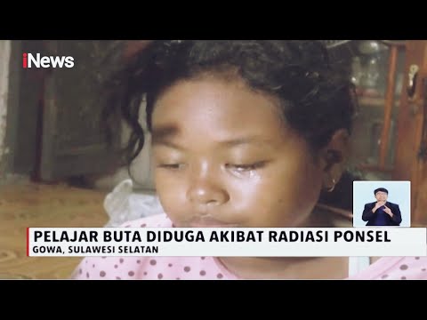 Siswi SD di Gowa Buta Diduga Akibat Radiasi HP saat Belajar Online - iNews Siang 20/11