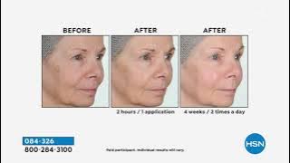 Perlier Supersize Black Rice Hyaluronic Acid Gel AutoShip