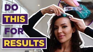 Dermaroller for Hair Loss: How to get results and MAJOR hair growth screenshot 3