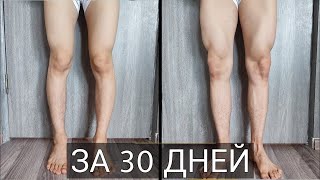 Как исправить кривые ноги за 30 дней в домашних условиях. Мой опыт