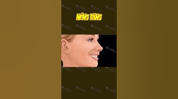 [3D] NIỀNG RĂNG || Nha Khoa Quốc Tế Athena