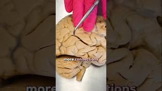 Brain Synapses vs AI “Synapses”