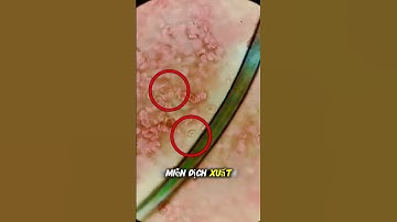 Cuộc chiến sinh tử giữa bạch cầu và ký sinh trùng #shorts