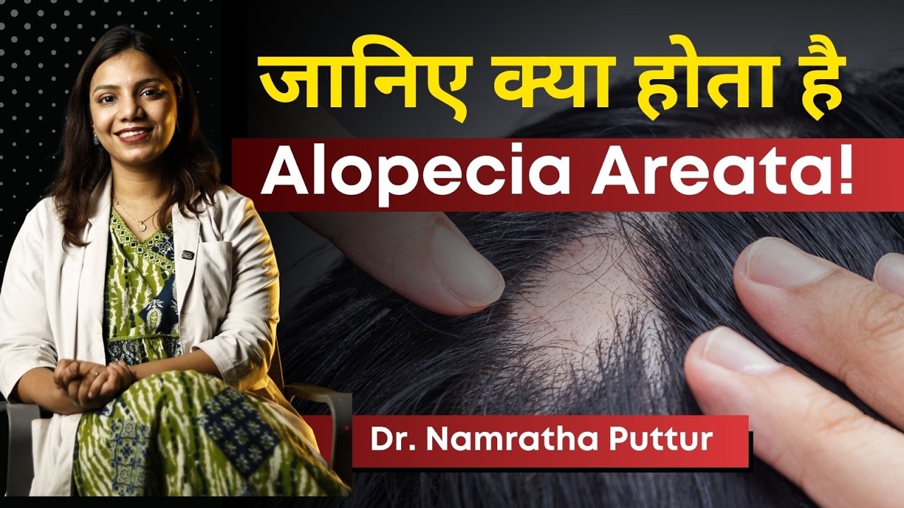 जानिए क्या होता है Alopecia Areata! | Sudden Bald Patches on Scalp: Causes and Cure! | HairMD Clinic