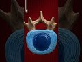 حقنة جديدة لعلاج آلام العمود الفقري