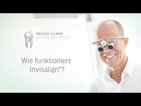 Wie funktioniert Invisalign?  // ZA Michael Illner im Interview