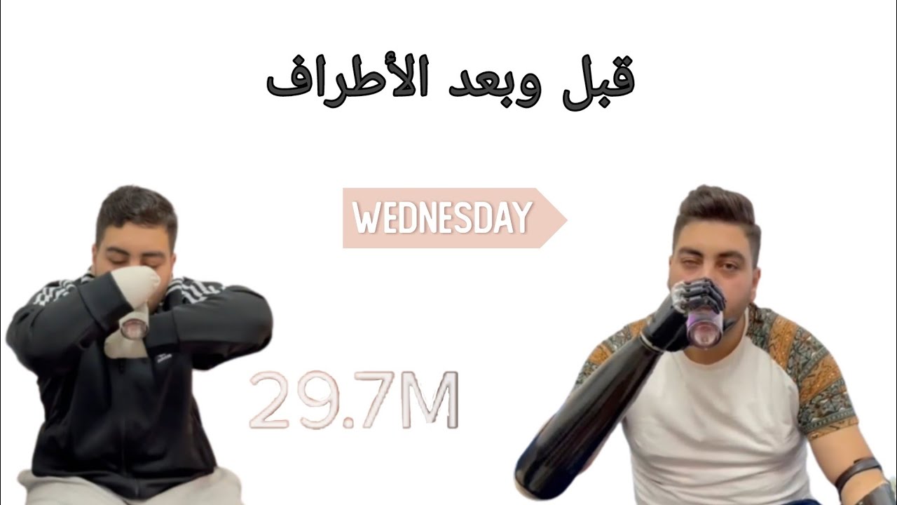 الأشياء الي كانت صعبة علي بدون الأطراف صارت سهلة مع الأطراف 🦾⁉️