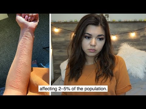 Living with a Chronic Skin Disease (Dermographism) | Steph Pappas