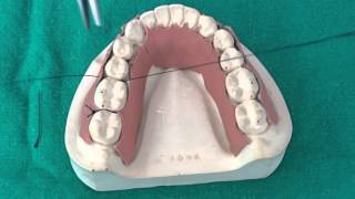 Peridontal Suturing Techniques