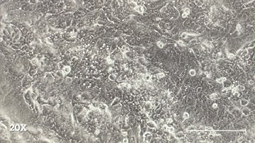 Transmission vs  Calcium Transient Assay in HL1 Cells