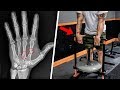 Hand Strength Exercises for Boxers: Wrist, Hand and Knuckle Injury Prevention