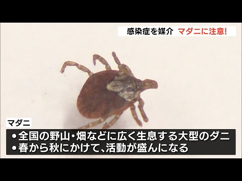 死に至る危険性　静岡県が感染症を媒介するマダニ　注意呼びかけ