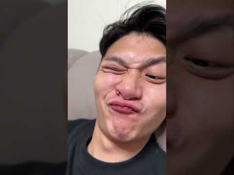 حباية صغيرة في وشك قادرة تمو9تك دكتور مصطفى  