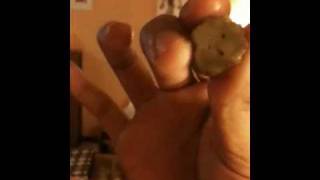 Rupture Des Cornichons