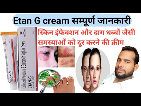 Etan G cream || Etan G cream uses in Hindi || स्किन इंफेक्शन और दाग धब्बों को खत्म करने की क्रीम
