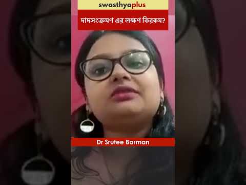 দাদ সংক্রমণ এর লক্ষণ কিরকম? | Symptoms of Fungal Infection | Ring Worm Dr Srutee Barman | #Shorts