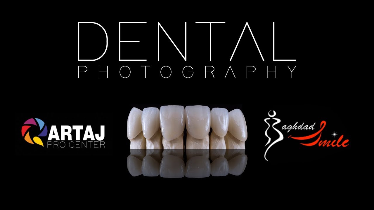 Dental Photography YouTube