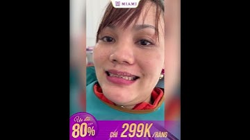 RĂNG SỨ LAVISH PREMIUM: NHẬP KHẨU CHÍNH HÃNG - TRẮNG TRONG TỰ NHIÊN