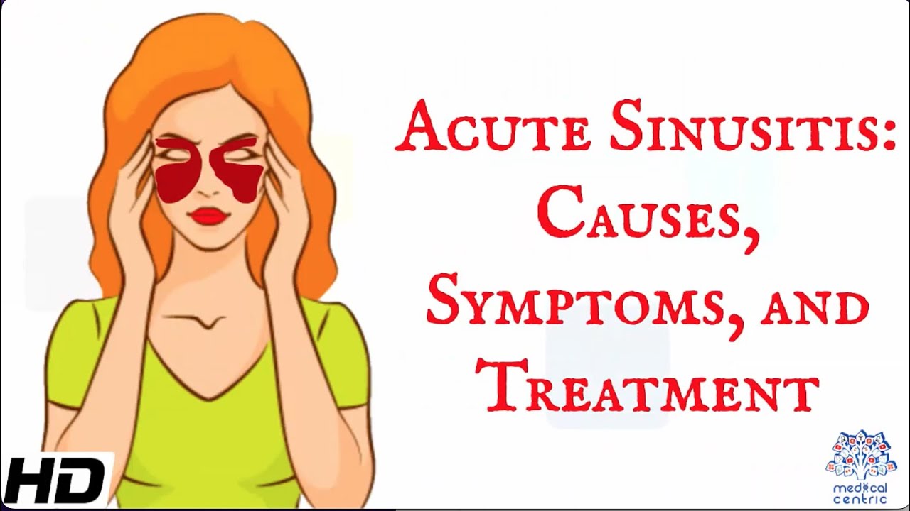 Sinus Infection (Sinusitis), Antibiotic Use