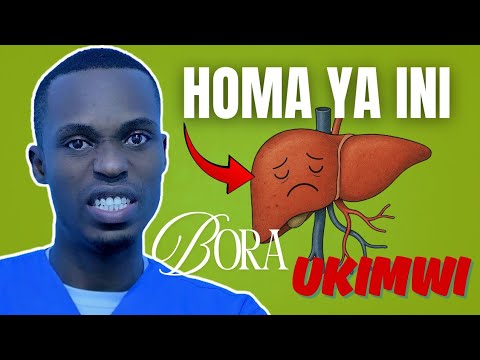 Usiogope UKIMWI OGOPA Homa YA Ini CHANJO ZIMEKUJA RASMI ZAPATIKANA HIVI