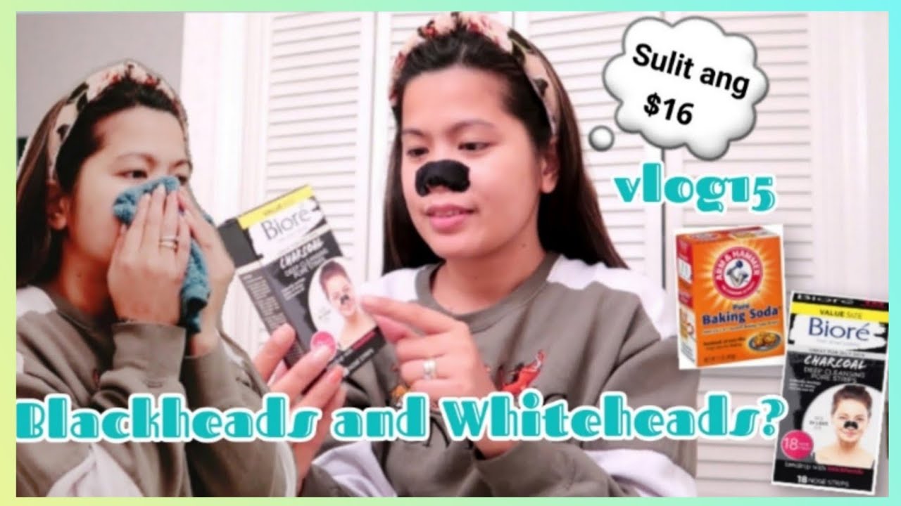 Best nose strips for Blackheads | Simply Den