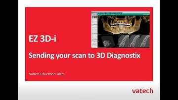 Ez3D-i : Export and Upload to 3DDX with STL