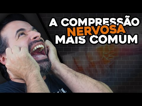 Vídeo: Síndrome De Compressão Nervosa: Causas, Tratamento E Muito Mais