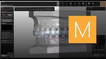 Bite Splints software module for Zirkonzahn.Modellier | Zirkonzahn.Software