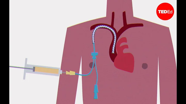 【TED-Ed】你的骨髓是如何造血的？@柚子木字幕組 - 天天要聞