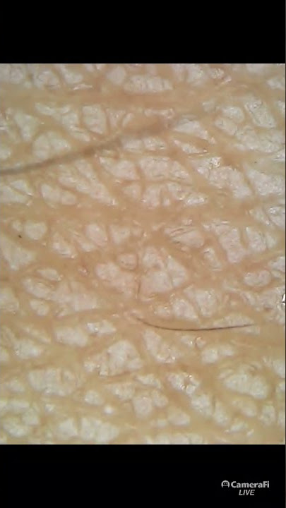 KULIT KERING DI BAWAH MIKROSKOP 1000X