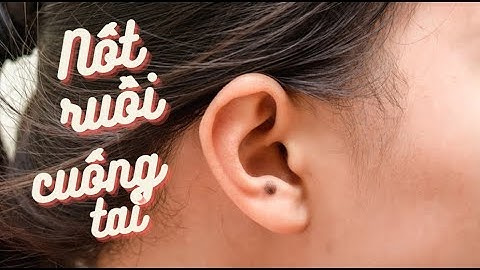 Nốt ruồi ở tai phụ nữ có ý nghĩa gì?