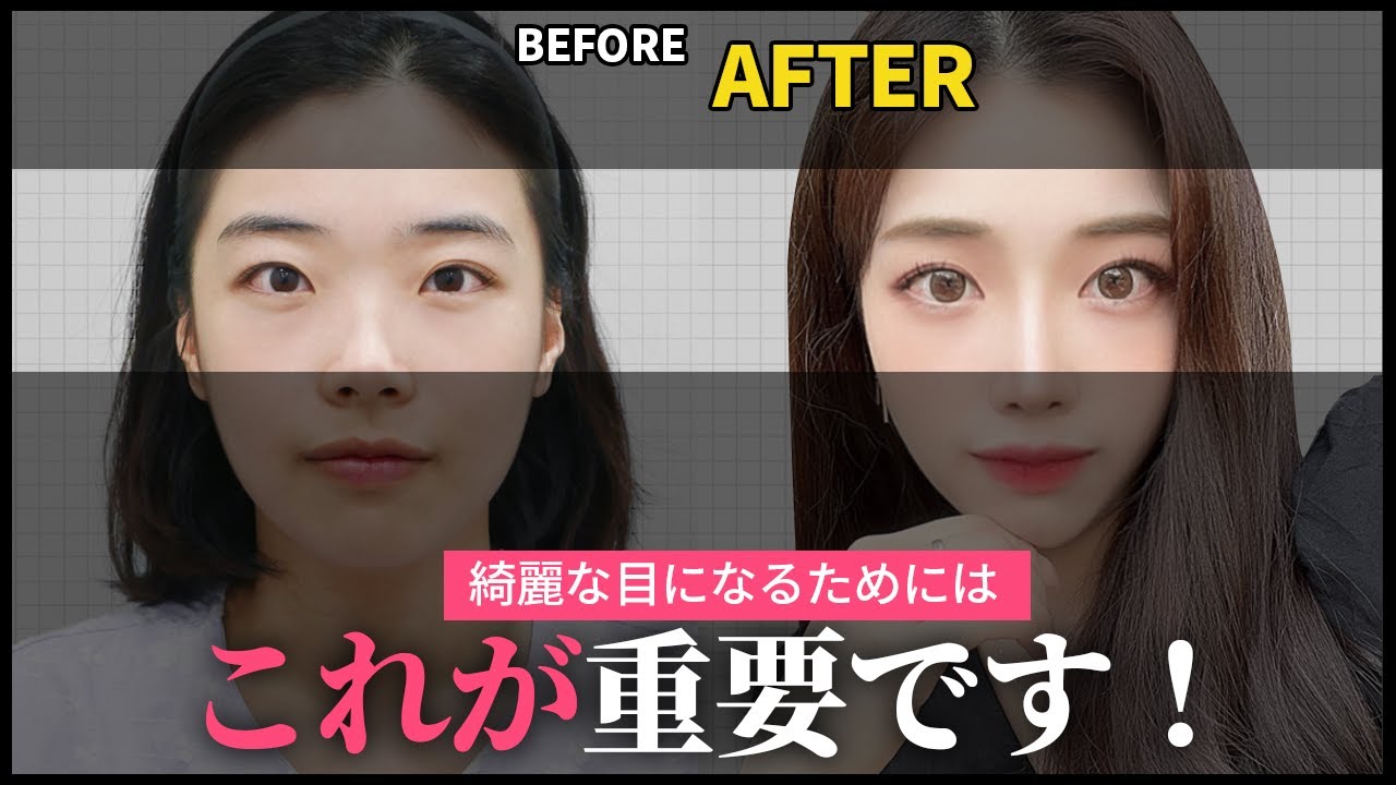 #目整形 #目頭切開 #蒙古ひだ #二重整形 #ビフォーアフター