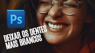 DEIXAR OS DENTES MAIS BRANCOS / Desfoquers Dicas