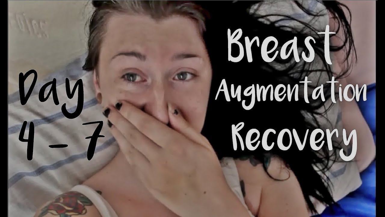 Day 4-7 Breast Augmentation Recovery | MtF
